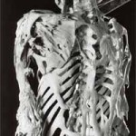 Harry Eastlacks FOP-skelett